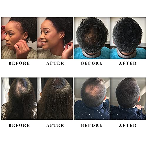 Saçları İnceltmek için Alfy Saç Lifleri-Erkekler ve Kadınlar için Birinci Sınıf Keratin Saç Bina Lifleri-Mevcut Kel Noktaları